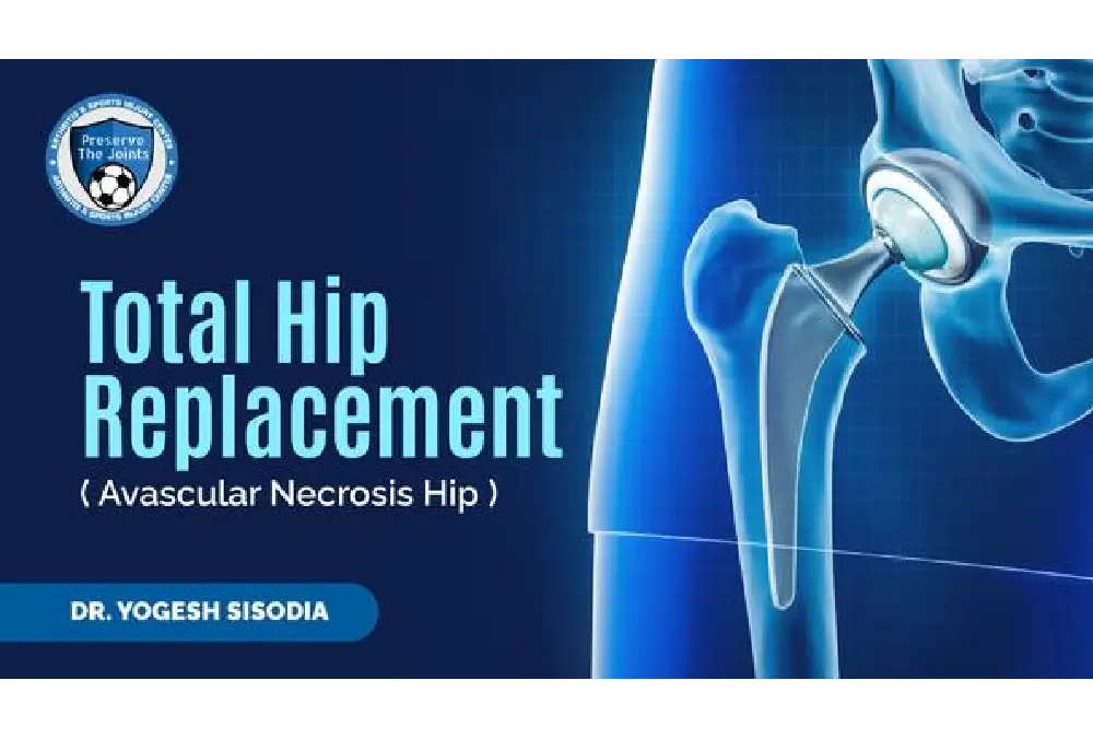 Considering hip replacement surgery but feeling hesitant?