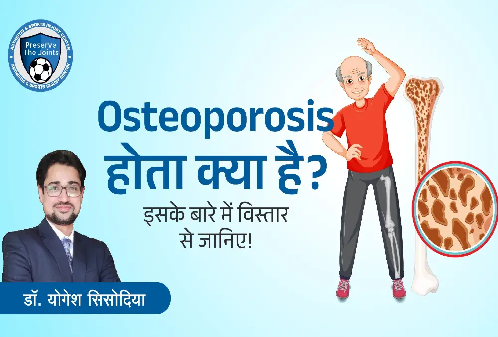 Understanding Osteoporosis: A Comprehensive Guide