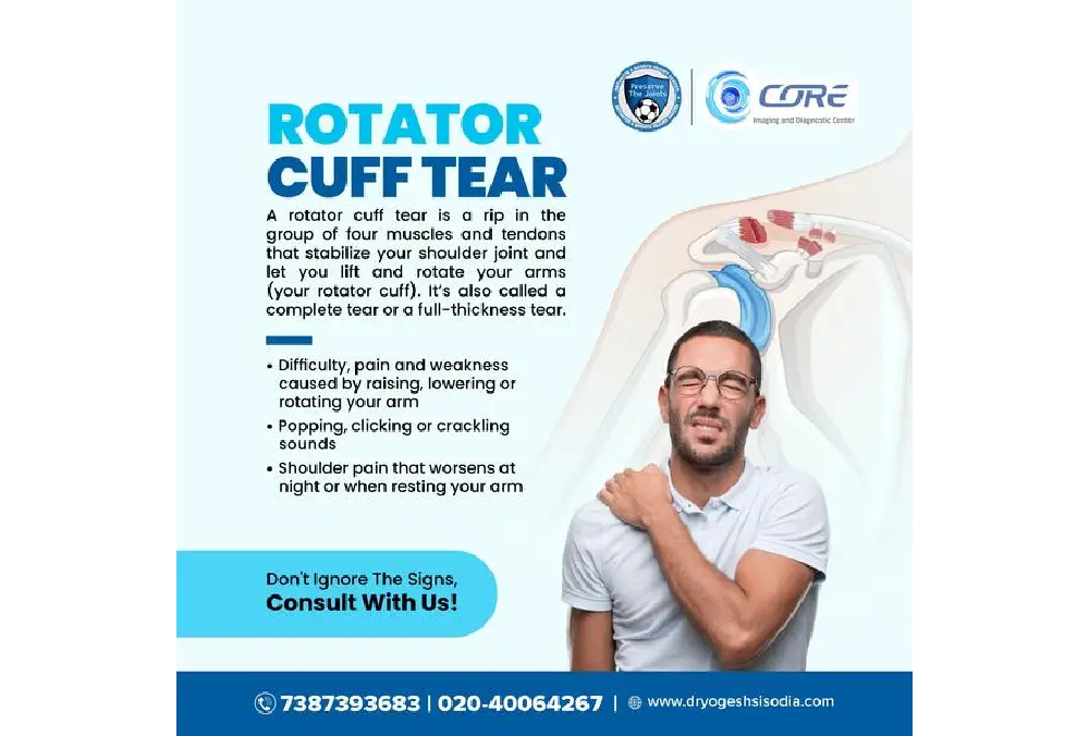 Shoulder Pain Got You Down? It Could Be a Rotator Cuff Tear