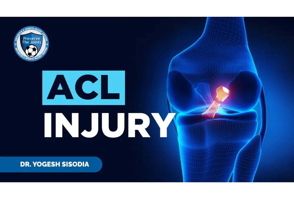 Understanding ACL Injuries: Early Intervention is Key