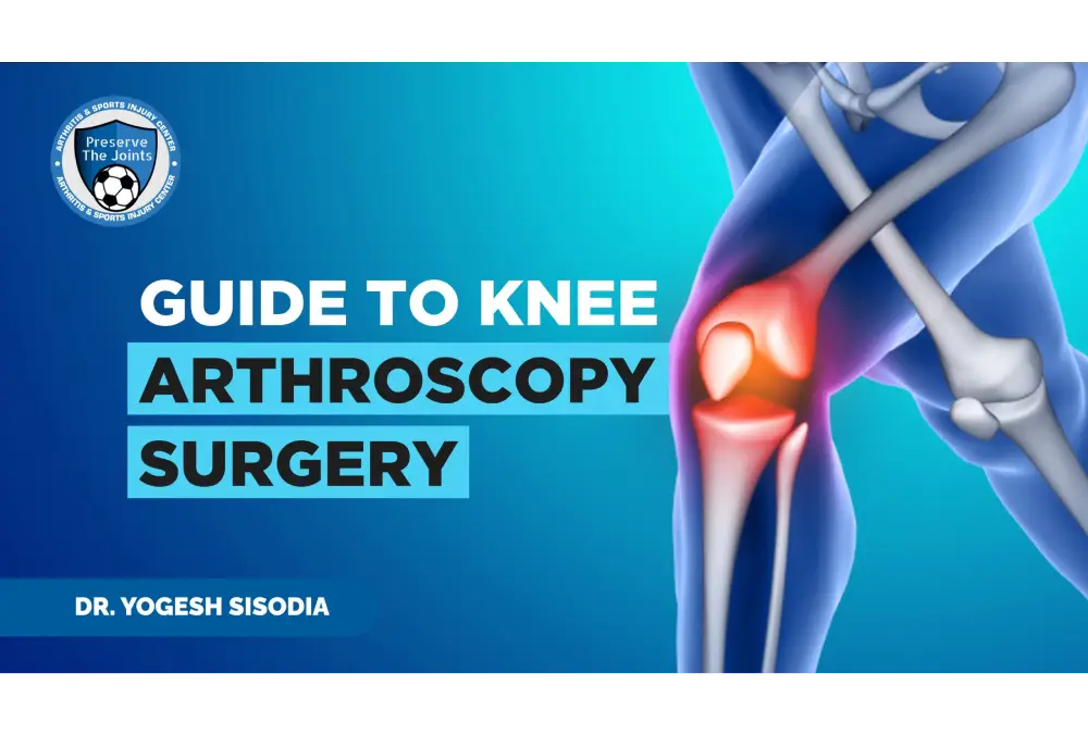 Your Guide to Knee Arthroscopy Surgery.